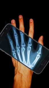 Xray Body Scanner Simulator apk