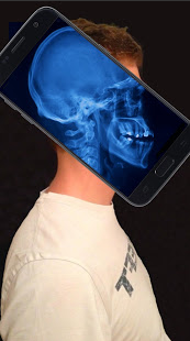 Xray Body Scanner Simulator apk